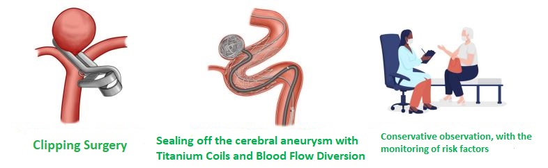 Cerebral-aneurysm-treatment - en
