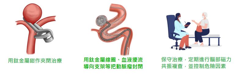 Cerebral-aneurysm-treatment